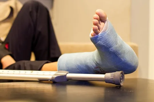 A broken leg in a blue cast with crutches nearby.